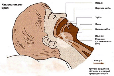 храп во сне