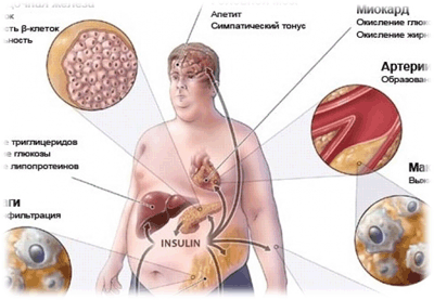 болезни обмена веществ