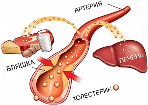 холестерин